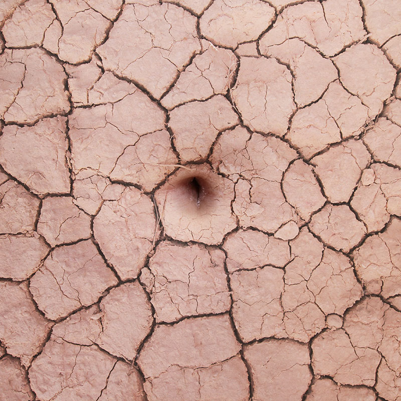 Biodermogenesi Treatment
