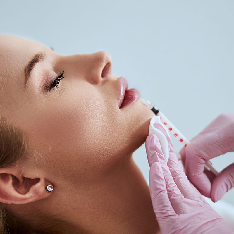 Dermal Fillers in Marylebone