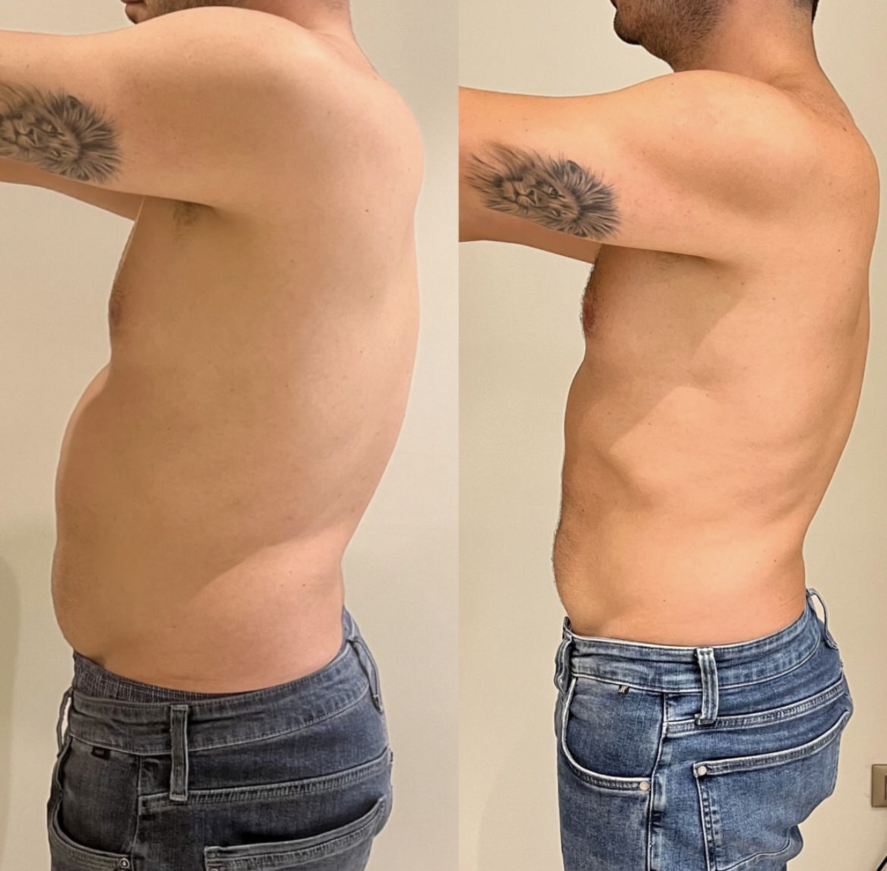 TESLA Former Before after photos