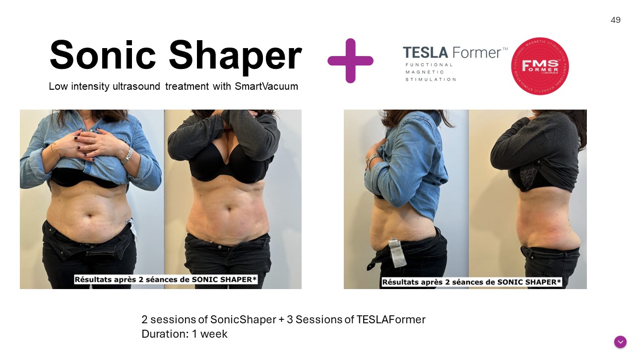 TESLAFormer DUO Before after photos