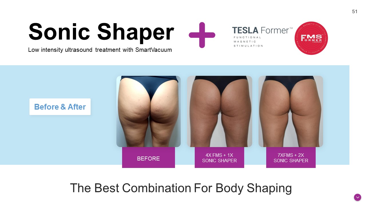 TESLAFormer DUO Before after photos